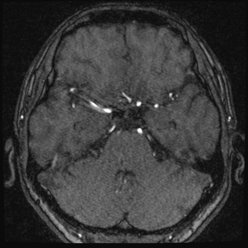 Click on the Serie image to view the images of VILLANUEVA, WILLIAM A.